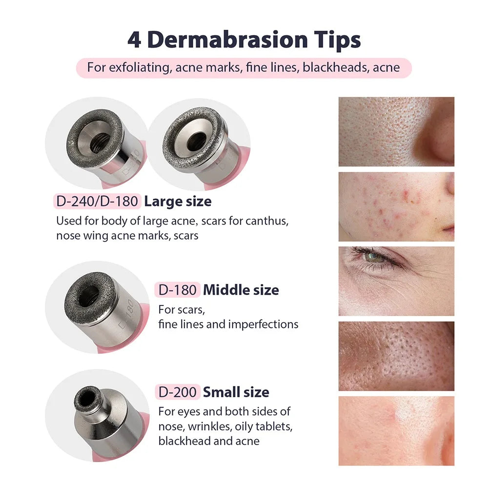 Portable Facial Exfoliation & Pore Cleaner